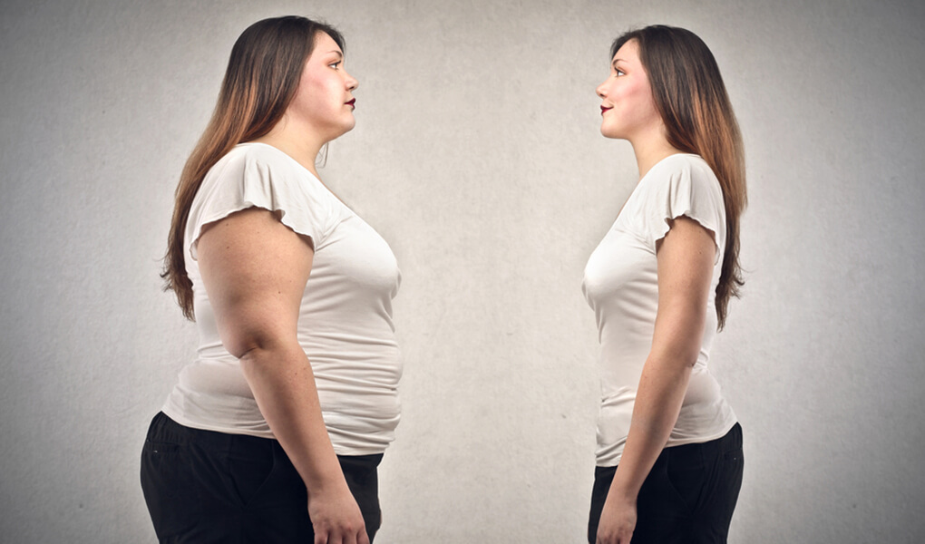Obezite (Şişmanlık) Kısırlığa Yol Açar mı? | Bahçeci Tüp Bebek